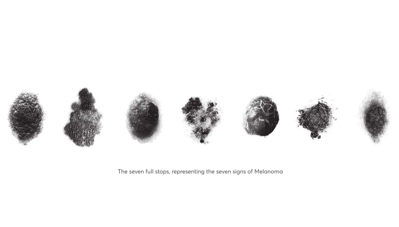 Melanoma-Font-1